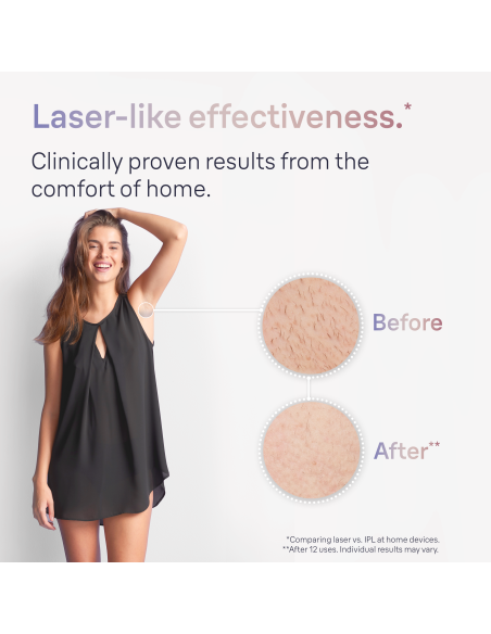 PL7147 Skin i·expert Pro7 IPL Fotoepilaator