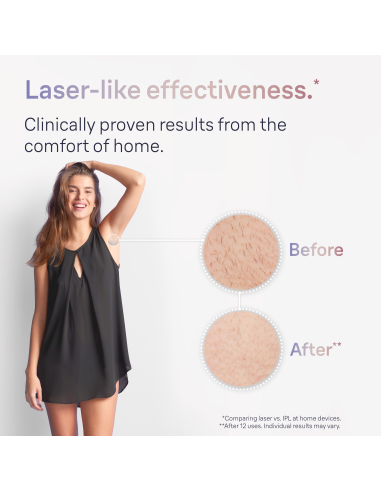 PL7147 Skin i·expert Pro7 IPL Fotoepilaator