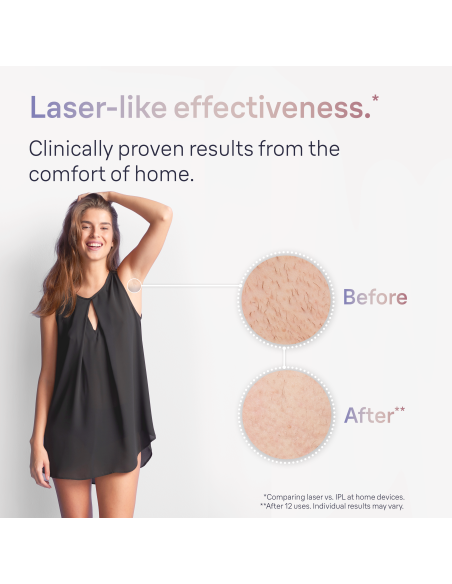 PL7147 Skin i·expert Pro7 IPL Fotoepilaator